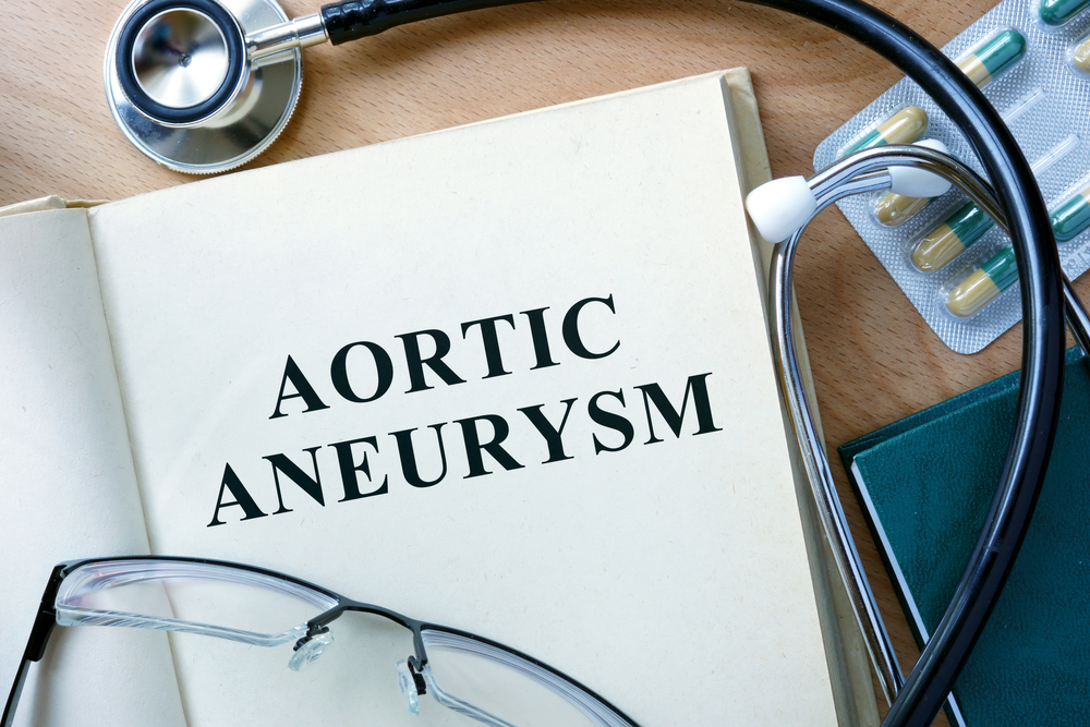 Aortic Aneurysm case report