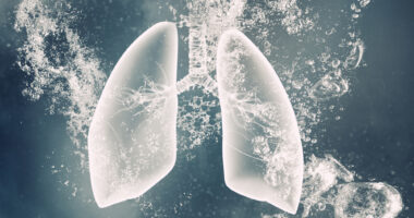 bleeding in lungs