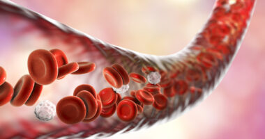 cholesterol