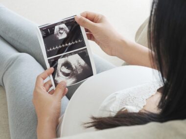pregnant women who develop AAV