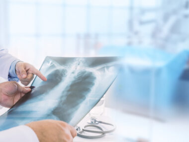 Overlap syndrome case
