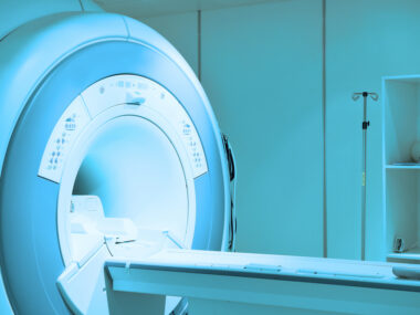 radiotherapy