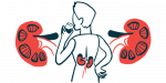 kidney failure | ANCA Vasculitis News | kidney | illustration of a woman's back, with kidneys highlighted