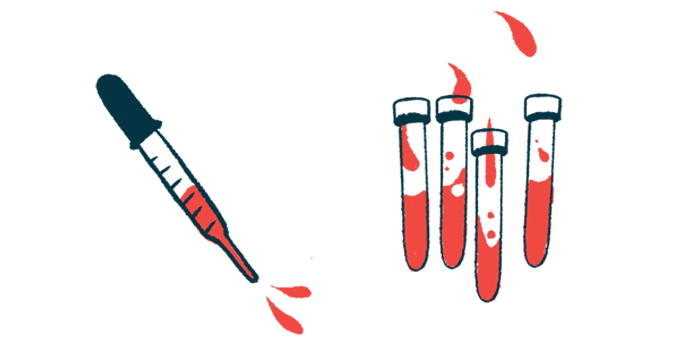 An illustration showing a pipette and vials, all partly filled with liquids for study in a lab.