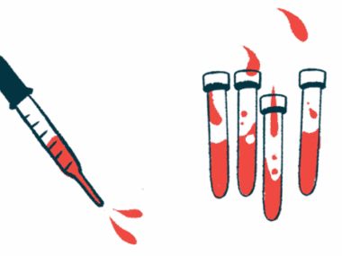 A dropper is shown next to four vials partly filled with red liquid.
