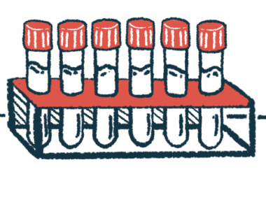 Six filled vials are seen stored on a rack.