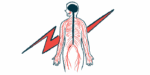 The brain, spinal cord, and peripheral nerves are highlighted on a silhouette of person, with a lightning blot in the background.