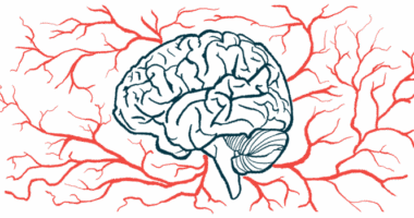 A side view of a brain in front of traces of blood vessels
