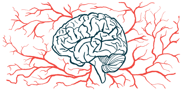 A side view of a brain in front of traces of blood vessels