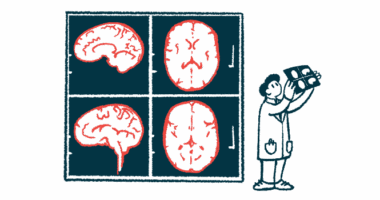 A clinician holds up a brain scan to review it alongside images of four brain scans illuminated on a wall.