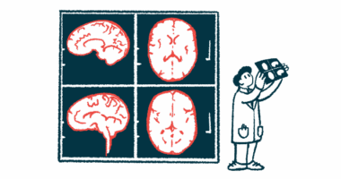 A clinician holds up a brain scan to review it alongside images of four brain scans illuminated on a wall.