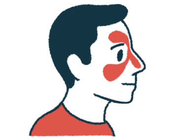 An illustration of a man with his sinus area highlighted.