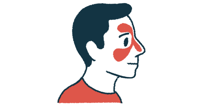 An illustration of a man with his sinus area highlighted.